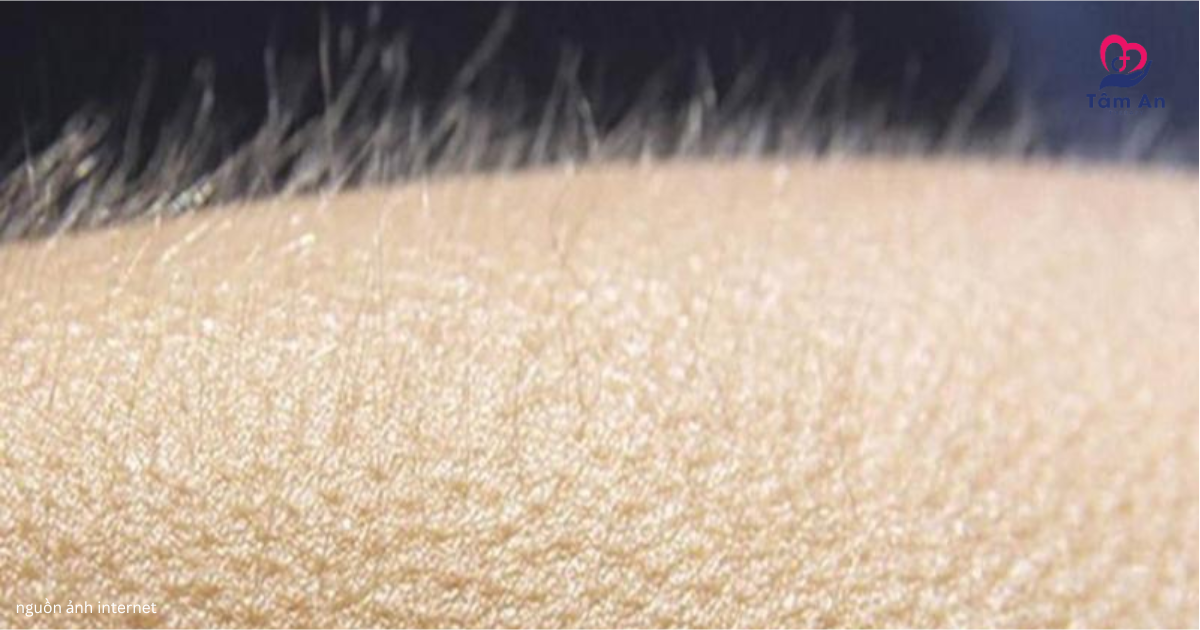 Cơ thể phản ứng mạnh mẽ ngay khi tiếp xúc với hình ảnh có nhiều lỗ nhỏ